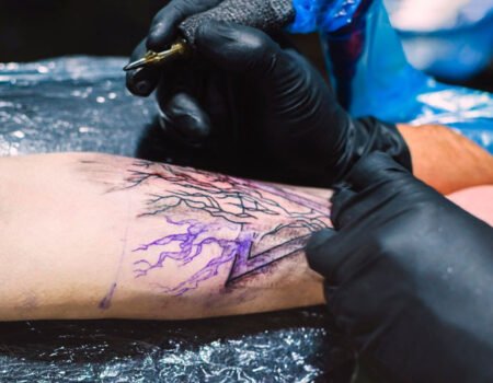 Affordable and Safe Tattoo Removal Options Near You