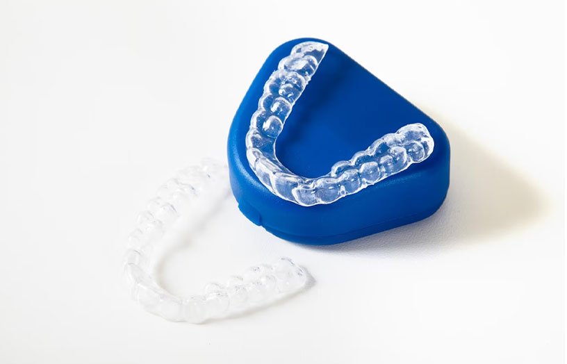 Clear Aligners: Align Your Smile with Your Dream Smile